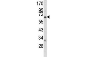 Western blot analysis of CYP2F1 antibody and A2058 lysate. (CYP2F1 antibody  (AA 395-424))